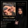 ریموو تاتو ابرو تخصصی با متد بدون درد و آسیب