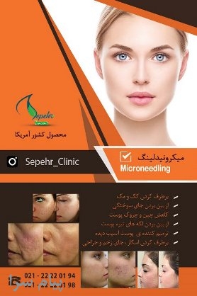 میکرونیدلینگ