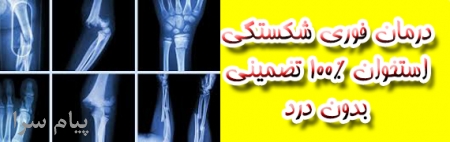 درمان فوری شکستگی استخوان