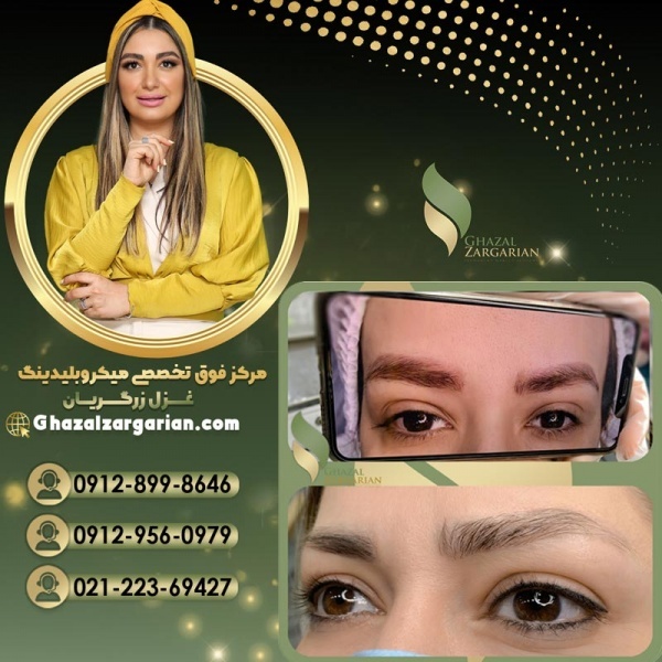 بهترین ریموور ابرو در آکادمی غزل زرگریان