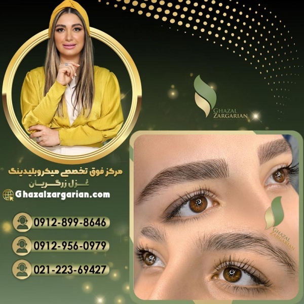 فیبروز ابرو در مرکز تخصصی غزل زرگریان