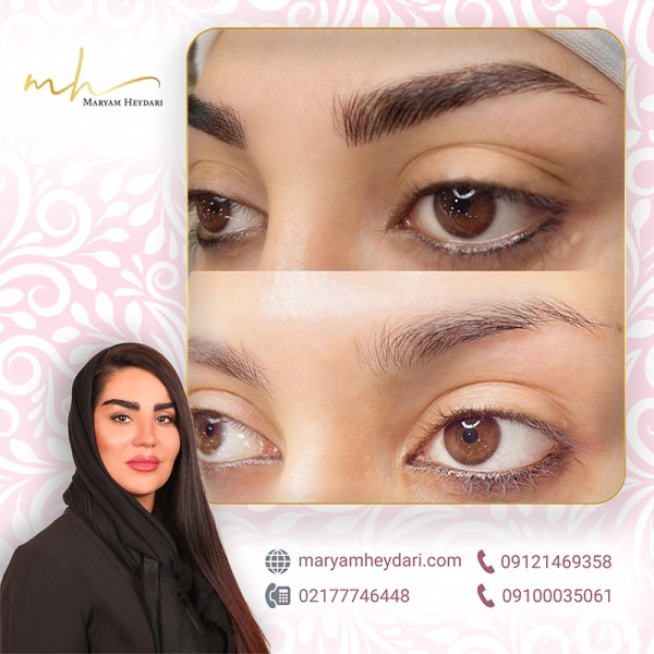 میکروبلیدینگ ابرو حرفه ای درمرکز فیبروز مریم حیدری