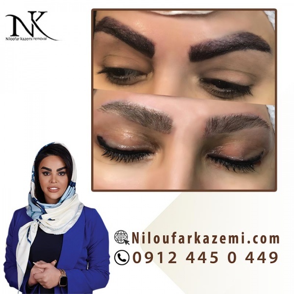 آموزش ریموو تاتو ابرو در مرکز تخصصی نیلوفر کاظمی