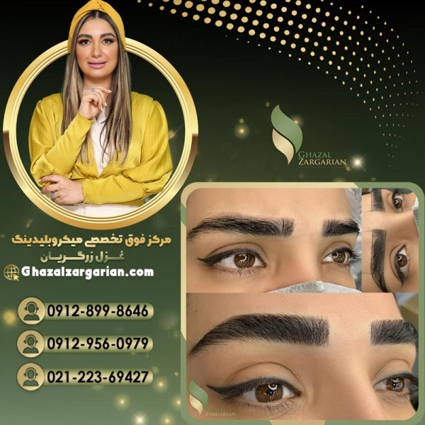 قیمت میکروپیگمنتیشن ابرو در آکادمی غزل زرگریان