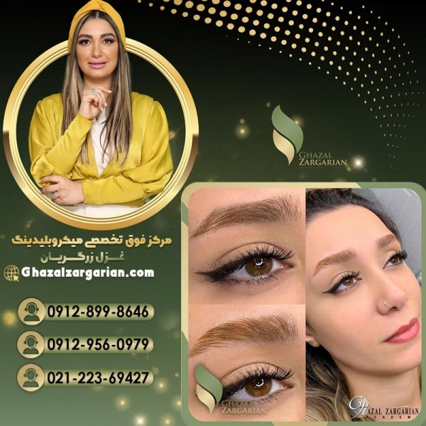 قیمت فیبروز ابرو در مرکز غزل زرگریان