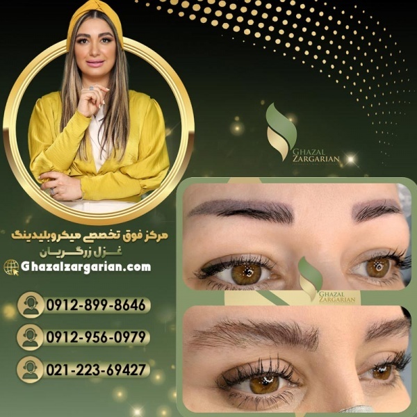 پاک کردن تاتو با مواد در بهترین مرکز ریموو تاتو