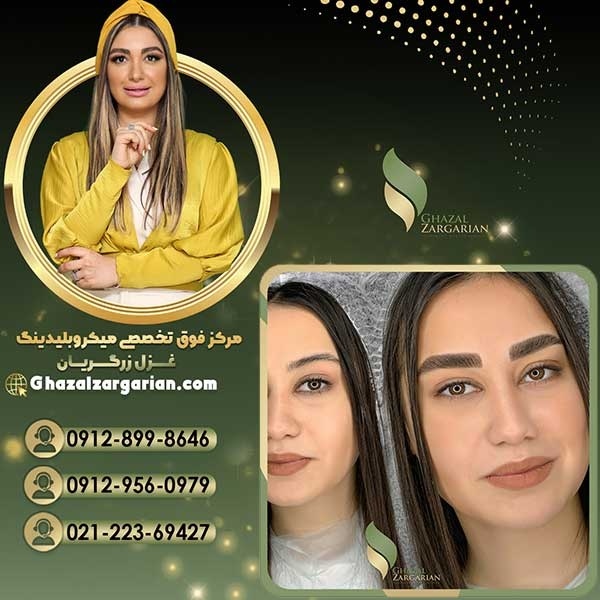 جدیدترین روش فیبروز به بهترین نحو ممکن