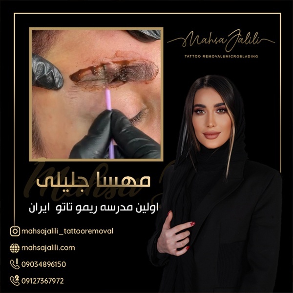 ریموو تاتو ابرو باقیمت استثنایی