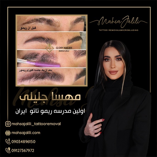 مادر ریموو تاتو ایران09127367972