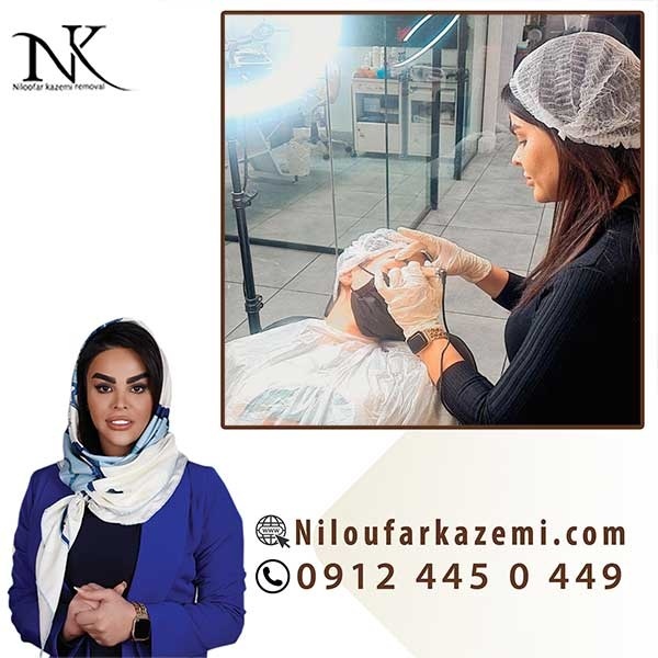 آموزش ریموو تاتو خط لب با ارائه مدرک معتبر