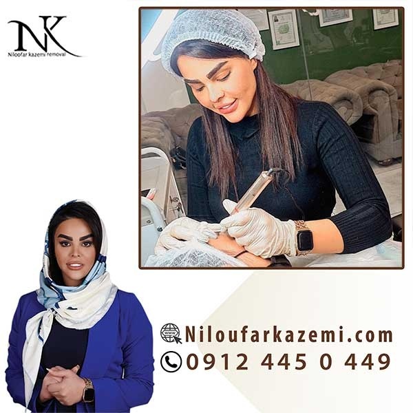 ریموو تاتو ابرو در یک جلسه