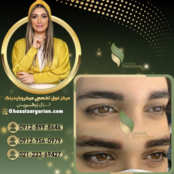 ریموو تاتو ابرو با بهترین و پیشرفته ترین تکنیک ها