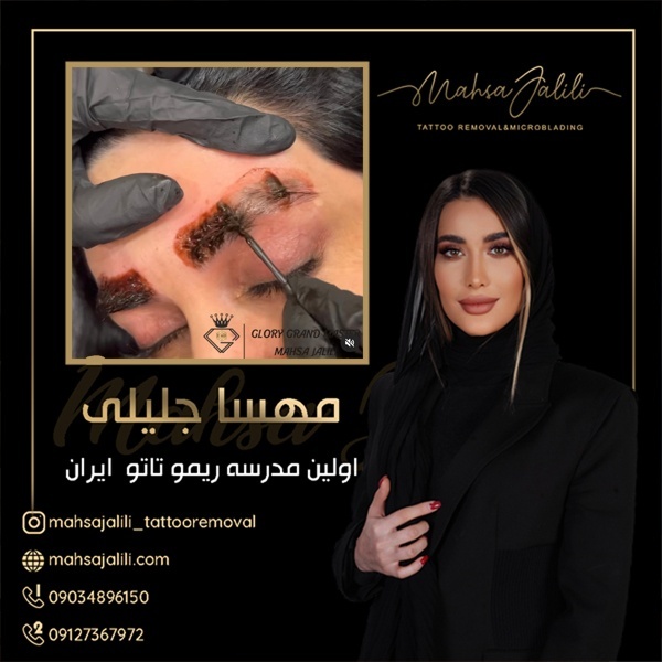 ریموو تاتو ابرو تخصصی با متد بدون درد و آسیب