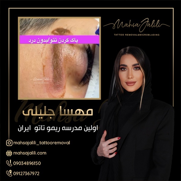 آموزش ریموو تاتو خط چشم به صورت جامع و کاربردی