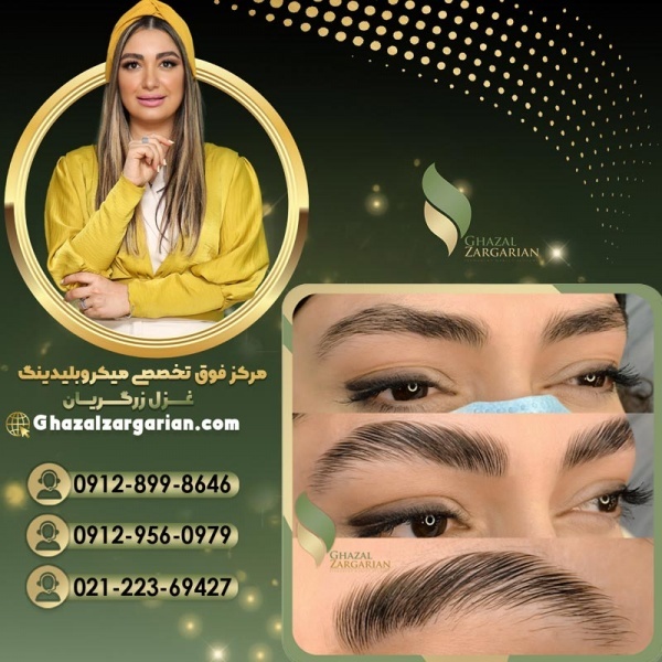 هزینه لیفت ابرو با مواد در بهترین مرکز آرایش دائم