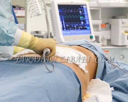 مراقبت بعد از عمل لیپوماتیک